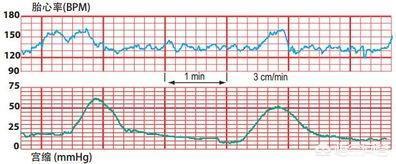 胎心男女有什么区别吗（胎心高低有什么区别）-第1张图片