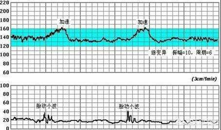 胎心率多少是男孩还是女孩（胎心率多少生男孩）-第1张图片