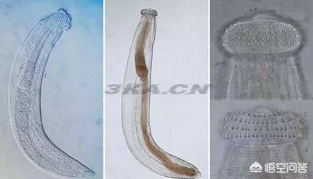 六大恐怖寄生虫图片（六大恐怖寄生虫的图片）-第11张图片